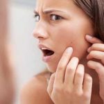 muli-benefits-for-pimple-treatment