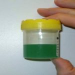 blue or green urine