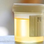 light-yellow-urine