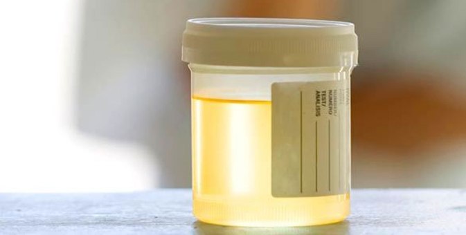 light-yellow-urine