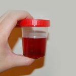 red-urine