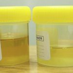yellow-urine
