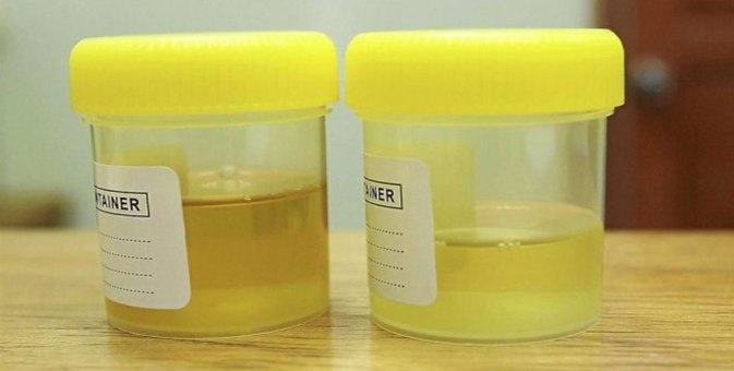 yellow-urine
