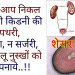 home-remedies-for-kidney-stones-hindi