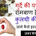 kidney-stone-home-remedy