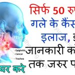 throat-cancer-treatment-in-only-50-rupees