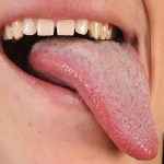 pink-tongue