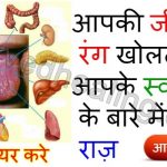 tongue-color-disease-in-hindi