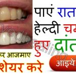 teeth-whitening-home-remedies