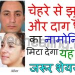 home-remedy-to-remove-wrinkle-or-black-spot-on-face-in-hindi
