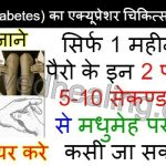 acupressure-therepy-for-diabetes